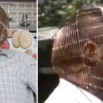 Man in Turkey uses Head cage to quit smoking