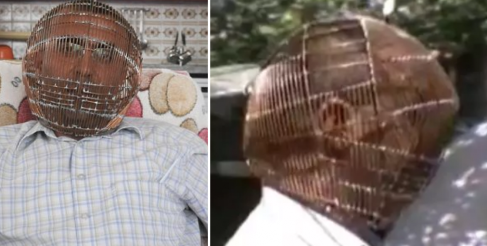 Man in Turkey uses Head cage to quit smoking