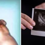 Man with twin inside