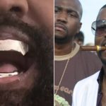 Kanye West titanium teeth