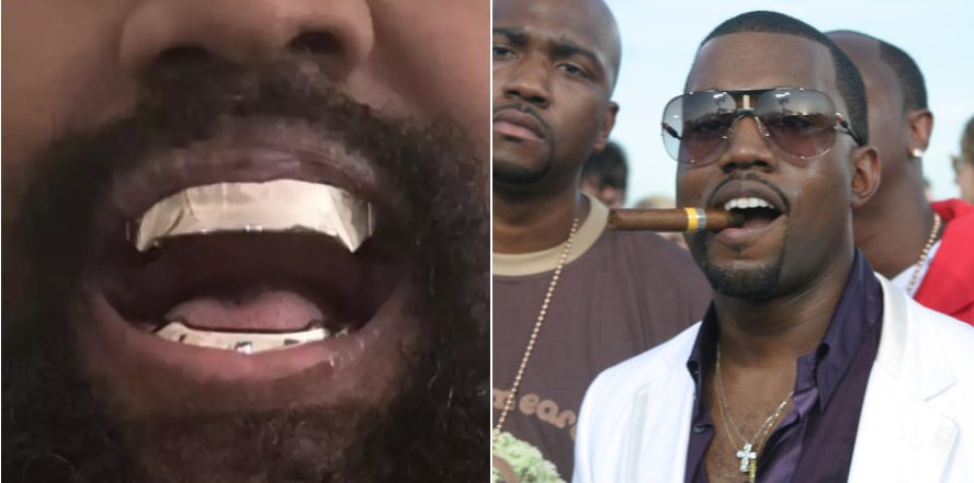 Kanye West titanium teeth