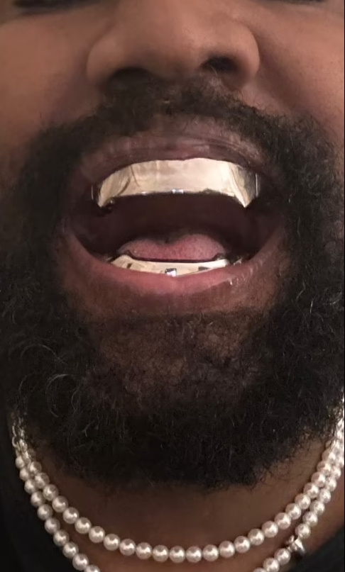 Kanye West titanium teeth