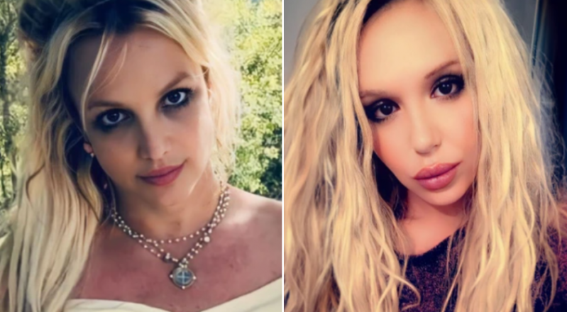 Plastic surgery Britney Spears