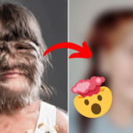 world's hairiest girl