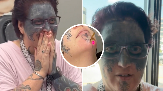 Face tattoo removal