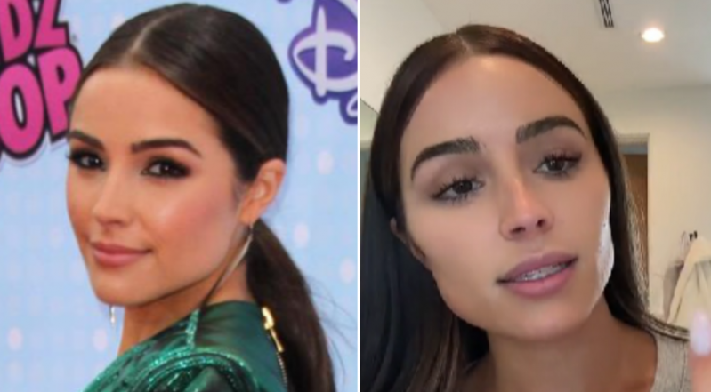 Olivia Culpo plastic surgery