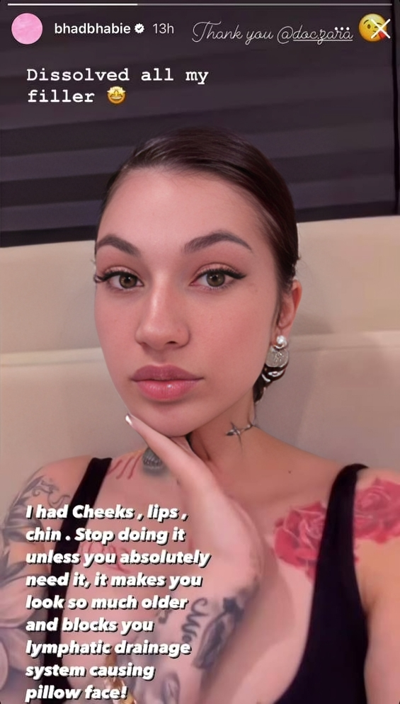 Bhad Bhabie removes facial fillers 