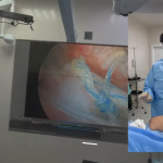 Apple Vision Pro surgery