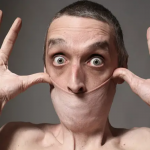 Man world stretchiest skin