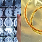 Parasite Woman Brain