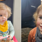 Toddler eye infection from kiss