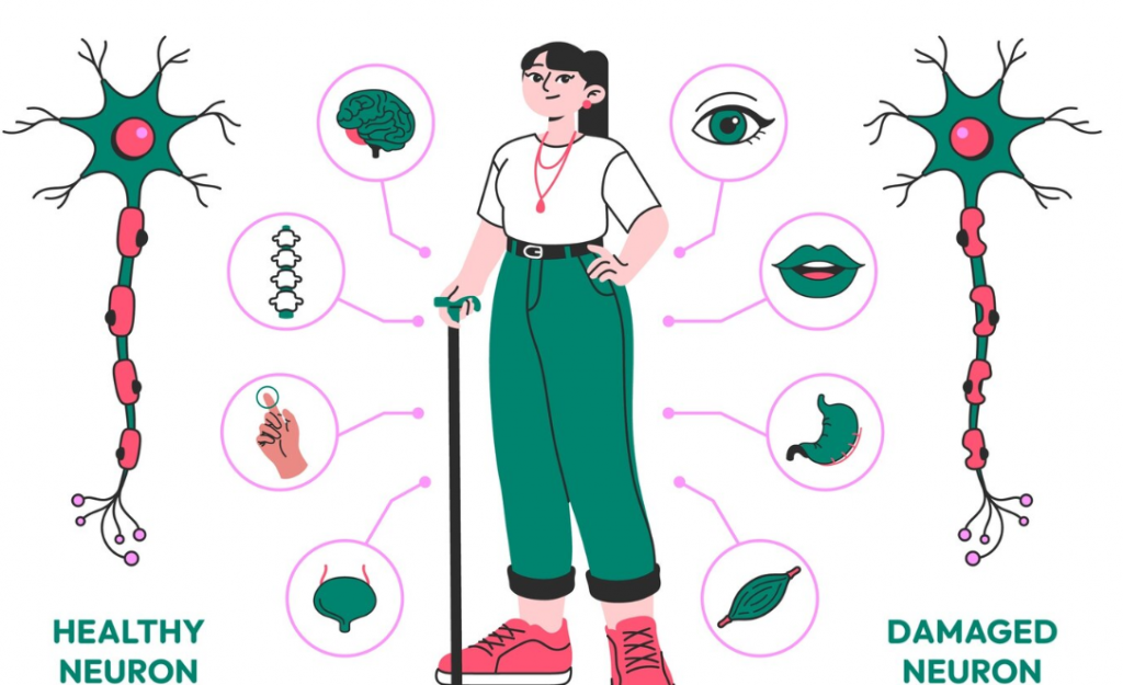 sclerosis
