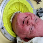 paul alexander iron lung