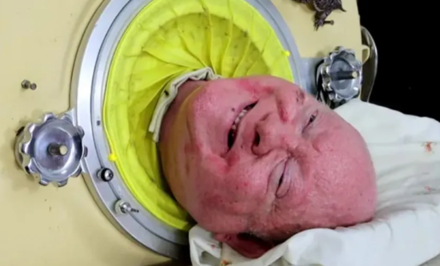 paul alexander iron lung