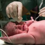 Artificial Womb Technology