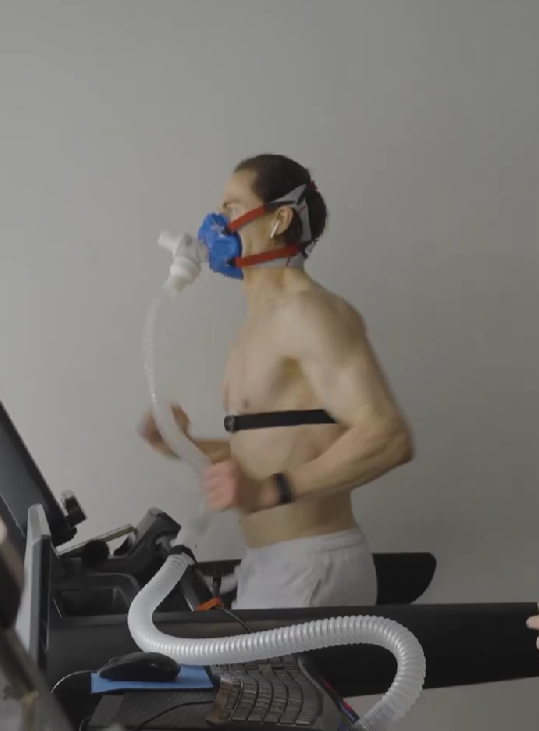 Hyperbaric Oxygen Therapy