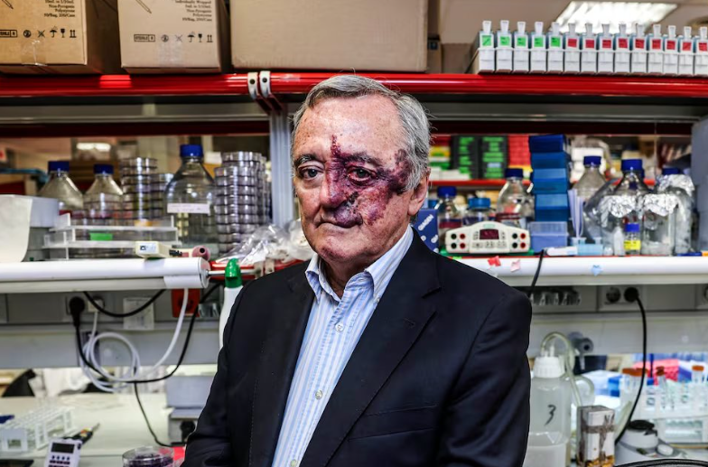 pancreatic cancer study tumor